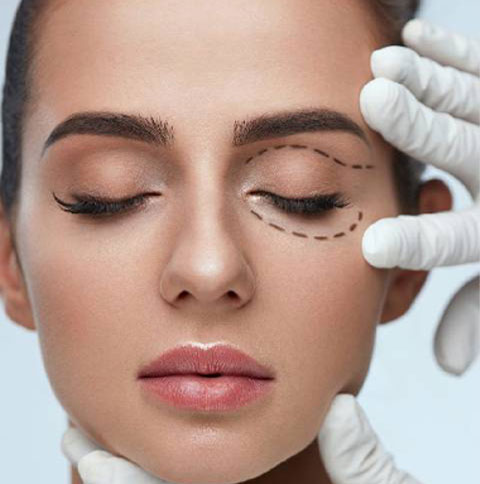 Indications for Blepharoplasty